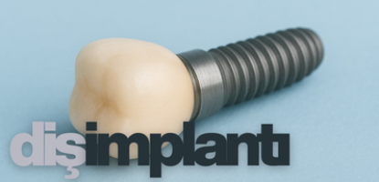 Diş İmplantları