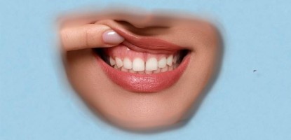 Periodontoloji